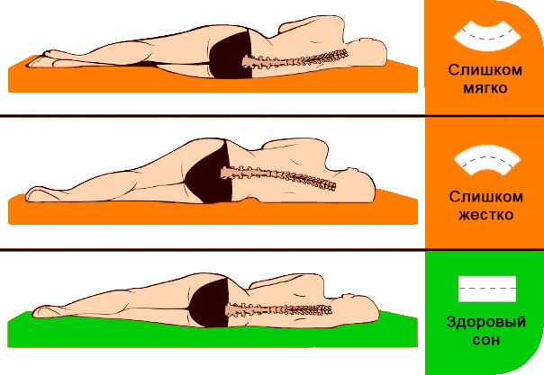 Orthopedische matras stevigheid
